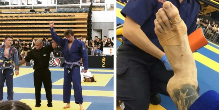 Adam Jones bjj